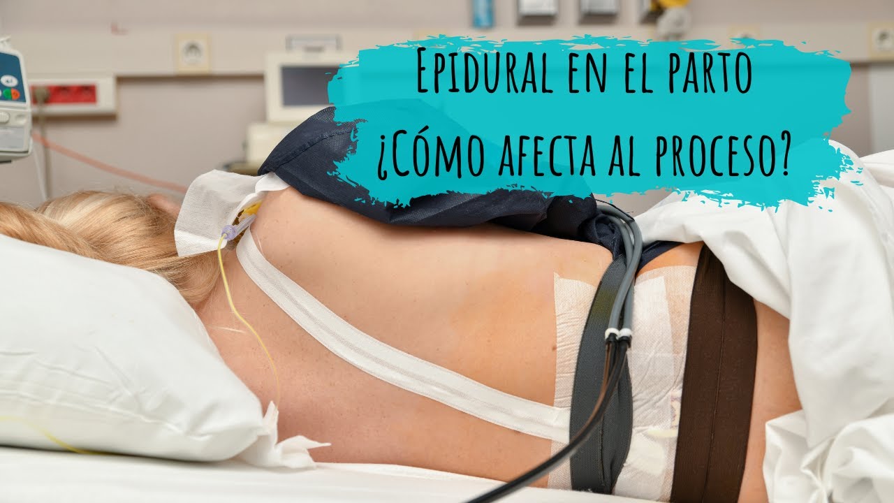 Advertencia: Efectos secundarios de la epidural en el parto