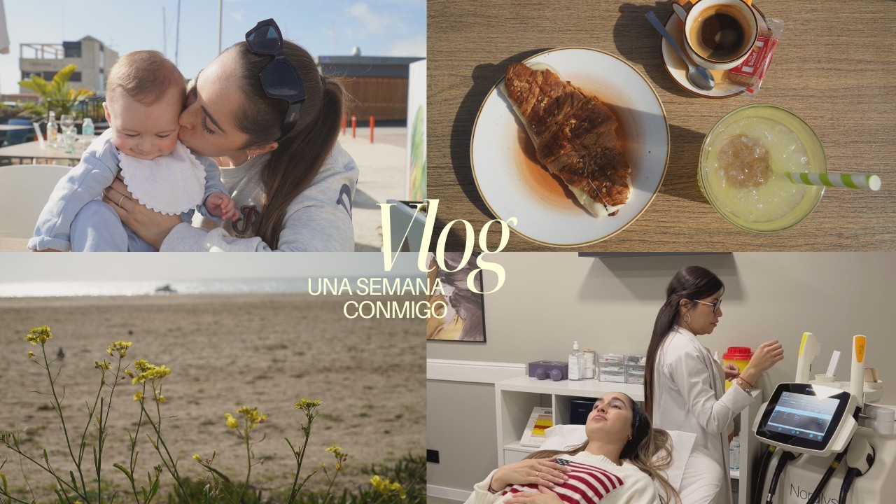Me hago LÁSER IPL en la cara + Organizo el lavadero | Vlog semanal