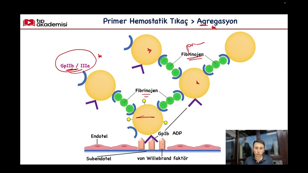 Hemodinamik Hastalıklar_Sorularla Patoloji Serisi_4