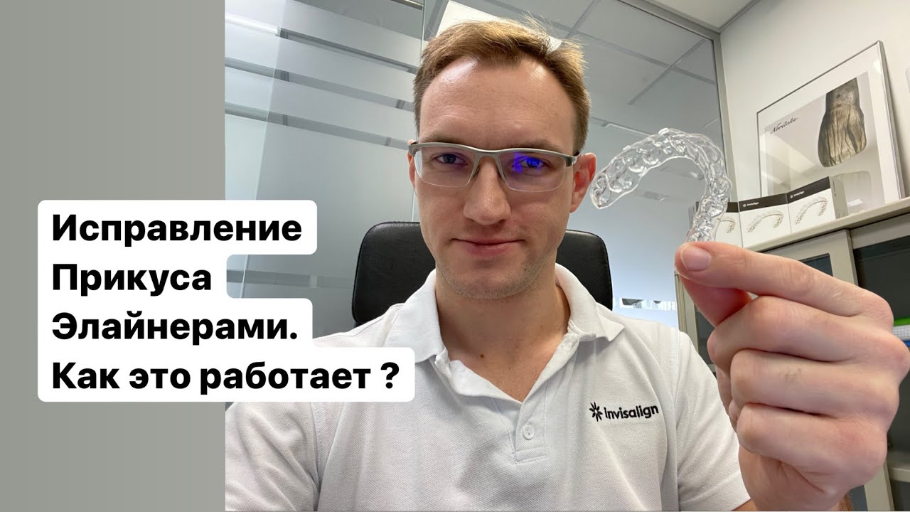 Элайнеры для исправления прикуса в Ульяновске. Как изготавливаются планируются выглядят. Стас Белоус