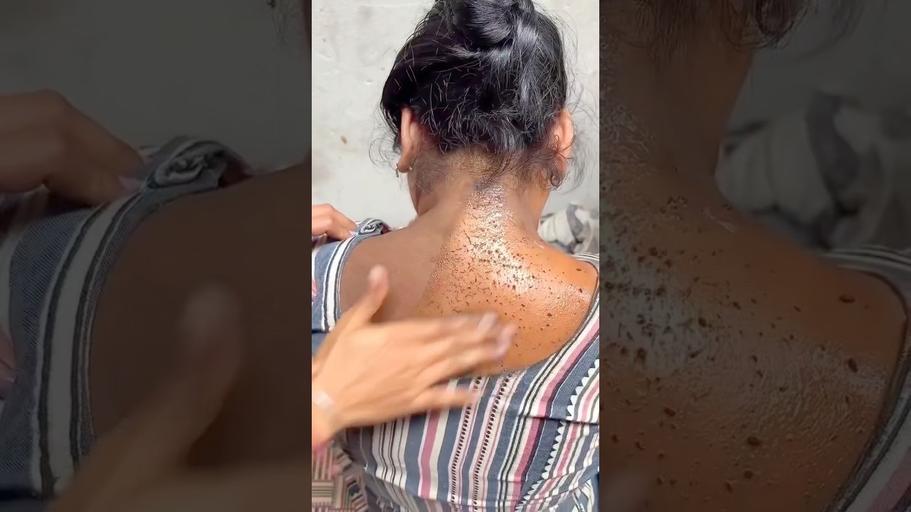 Remove Neck Dirt & TanningIn Just 2minutes✅#darknecksolution #neckcleaningtips #bleach