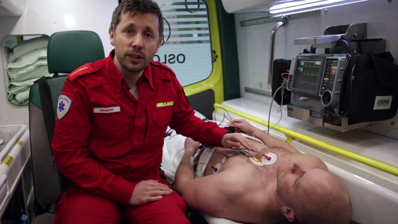 EKG: Elektrodeplassering