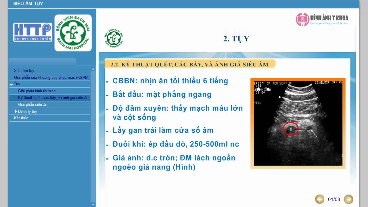 08. Siêu âm tuỵ - ThS. Lê Anh Tuấn (SIÊU ÂM TỔNG QUÁT BỆNH VIỆN BẠCH MAI)