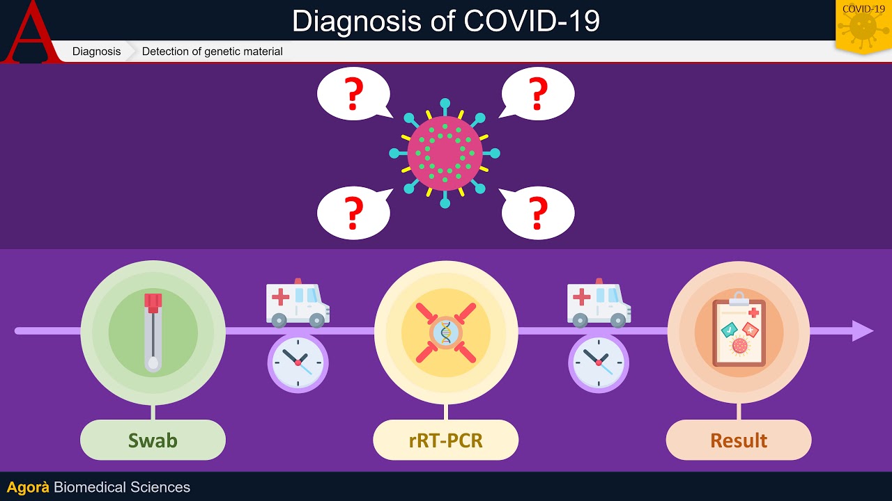 Diagnosis of COVID-19