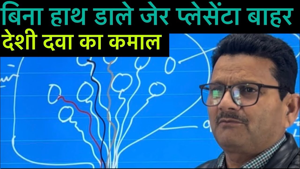 Retention of placenta l symptoms of placenta l dr Umar Khan 