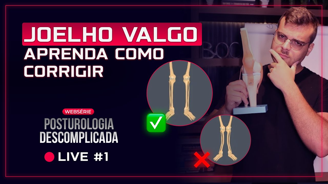 JOELHO VALGO: Aprenda como Identificar e Corrigir na Prática | Posturologia Descomplicada 