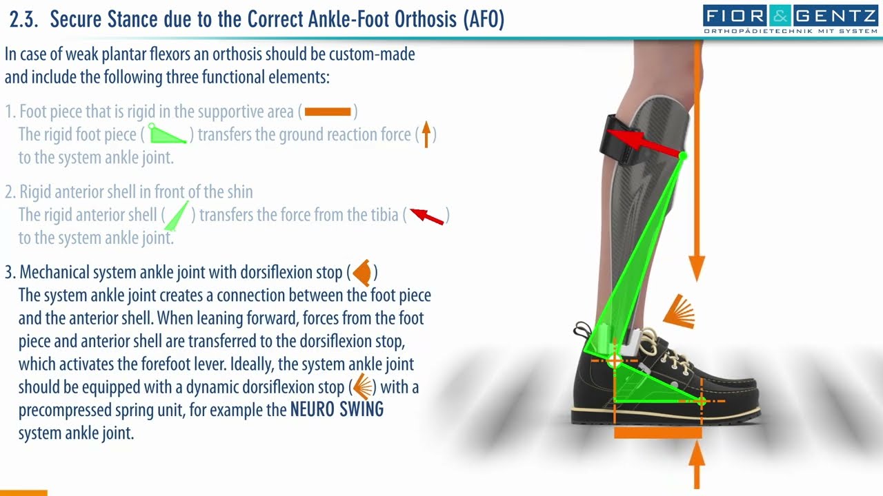 EN: The Right Orthosis in case of a Combined Weakness of the Dorsiflexors and Plantar Flexors (2/4)