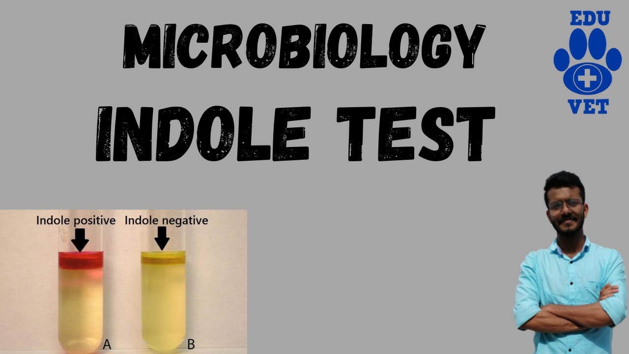 Indole Test-Microbiology