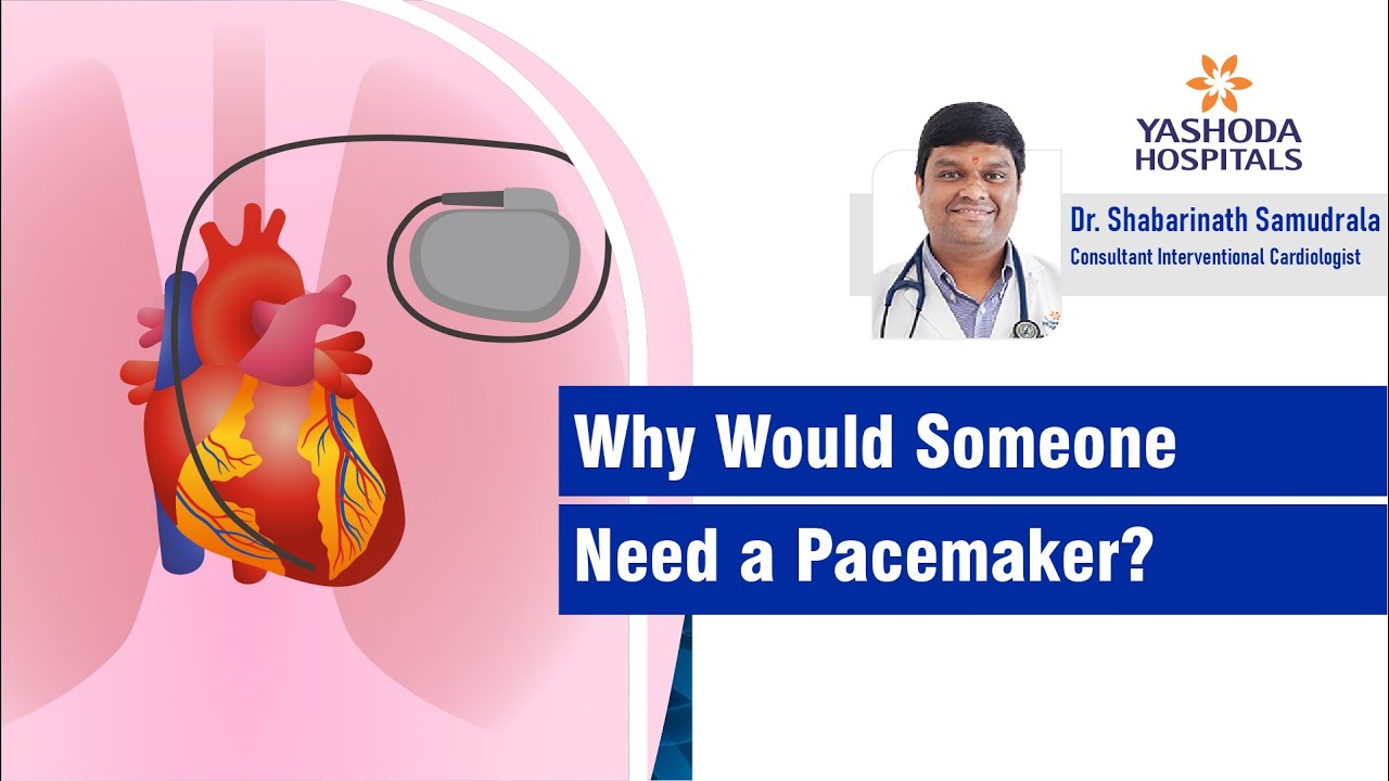 Why Would Someone Need a Pacemaker? | Dr. Shabarinath Samudrala