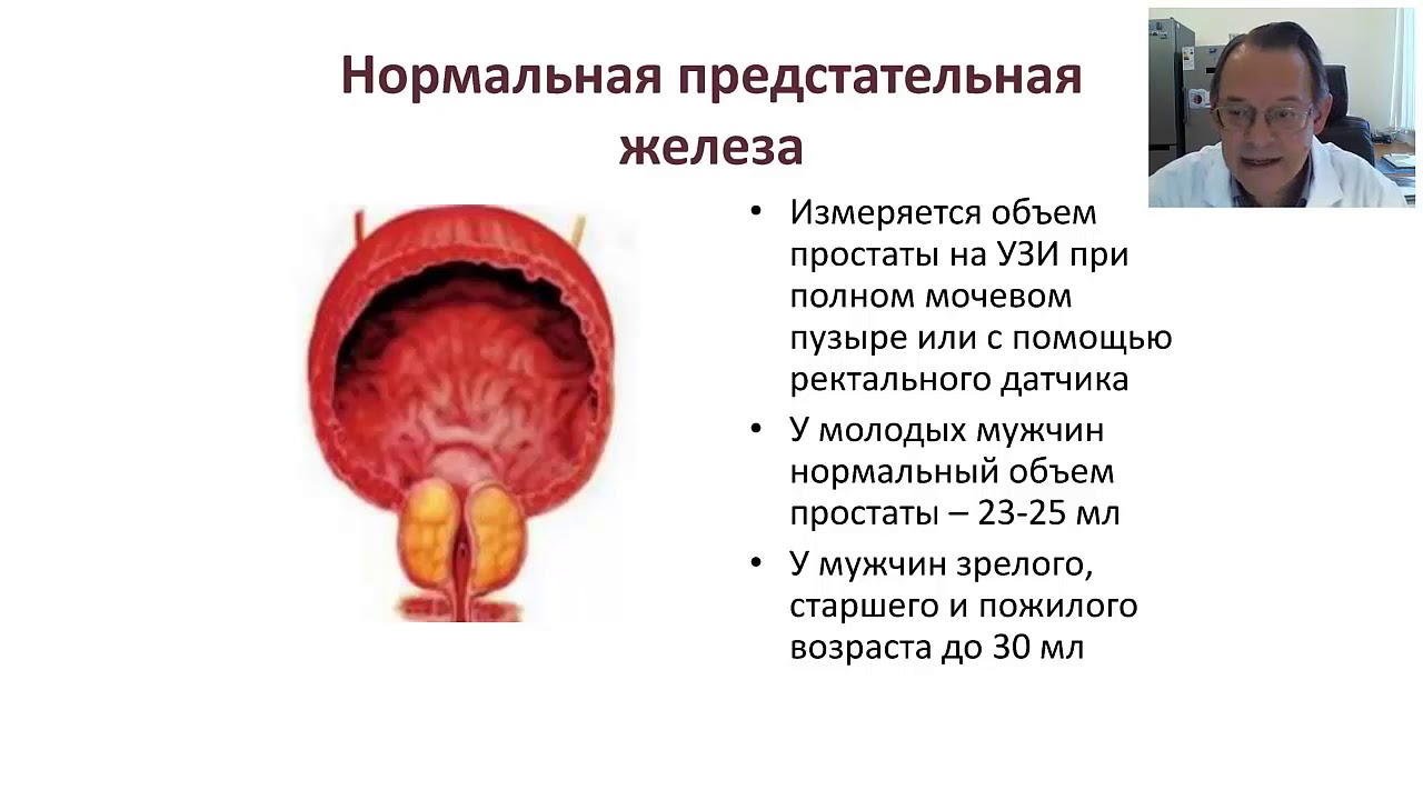 Здоровье предстательной железы мужчин