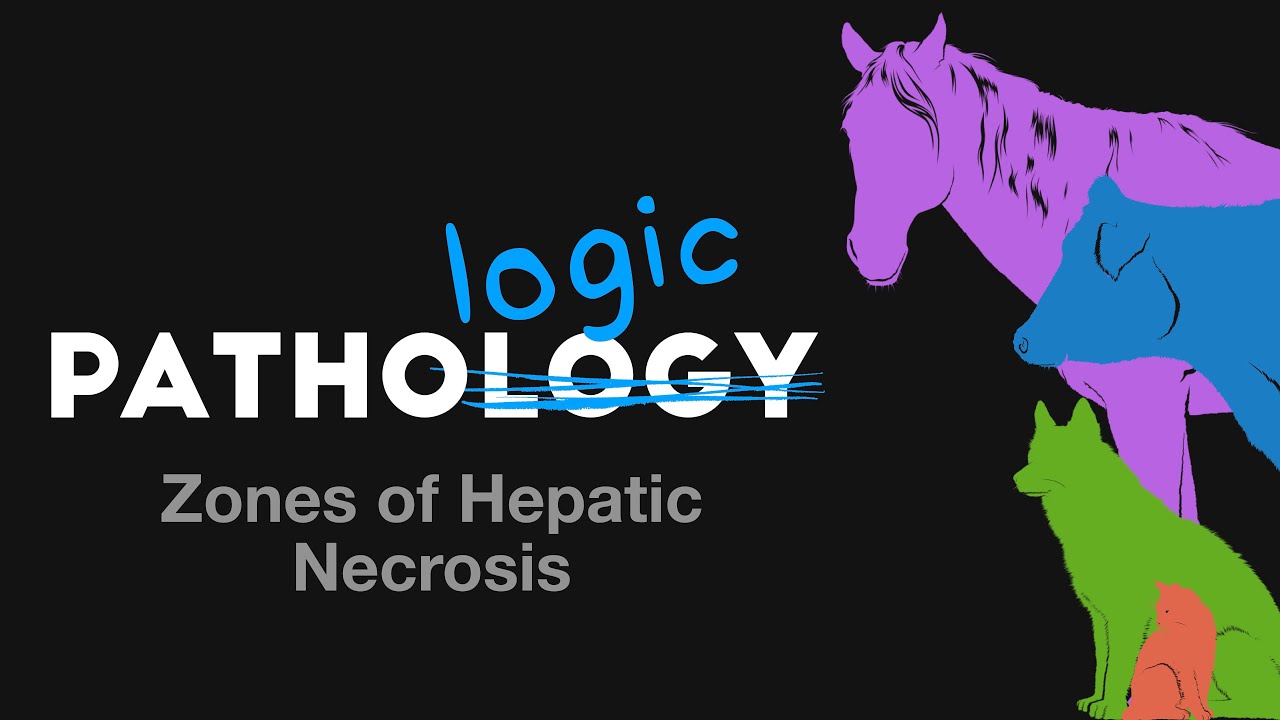 Zones of Hepatic Necrosis - PathoLogic