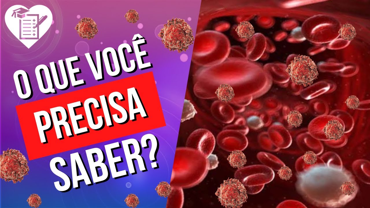 LEUCEMIA - Causas, Sintomas e Tratamento