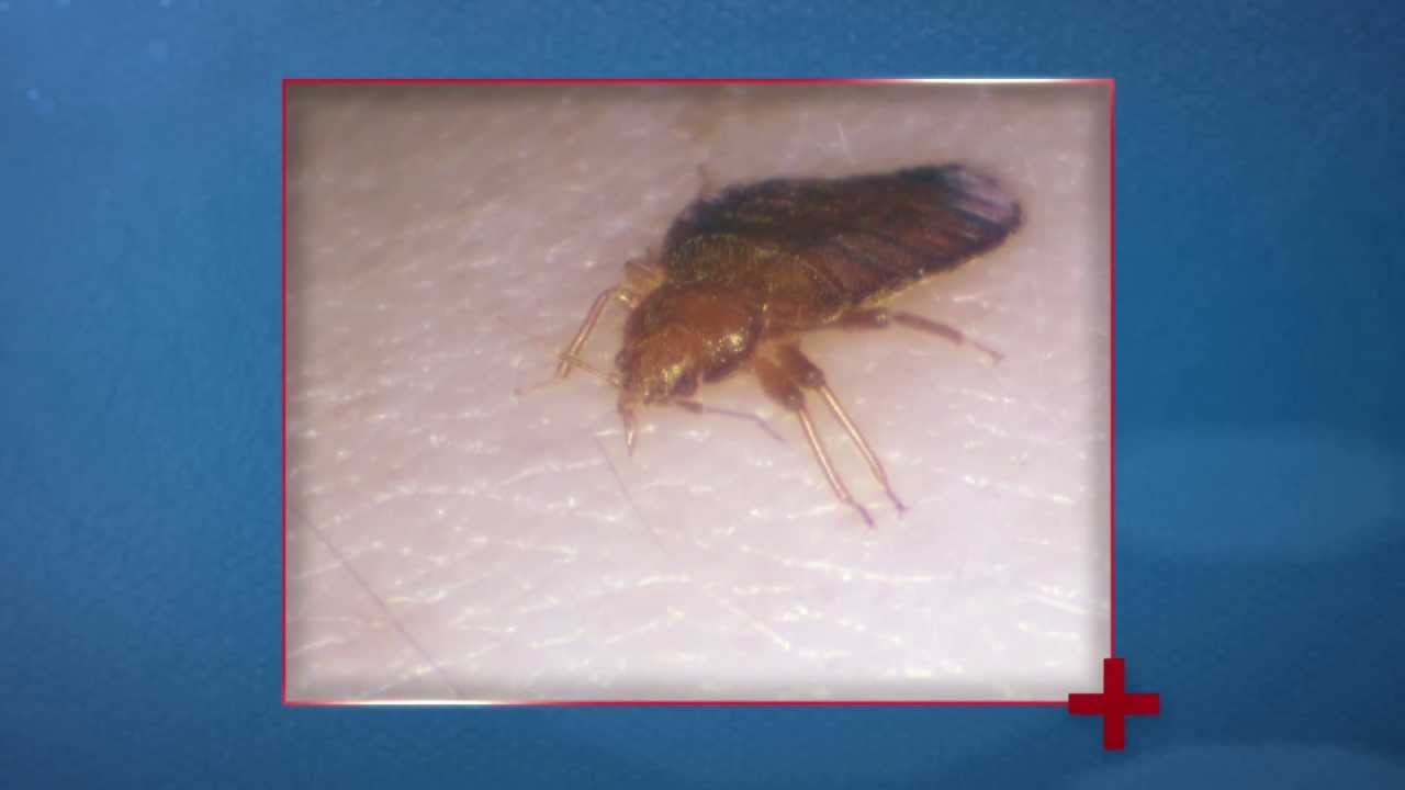Bed Bugs & Health: Do They Transmit Disease? | National Pest Management Association
