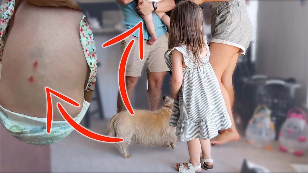 FURNITURE FELL ON TOP OF OUR BABY... *Scary Injury*