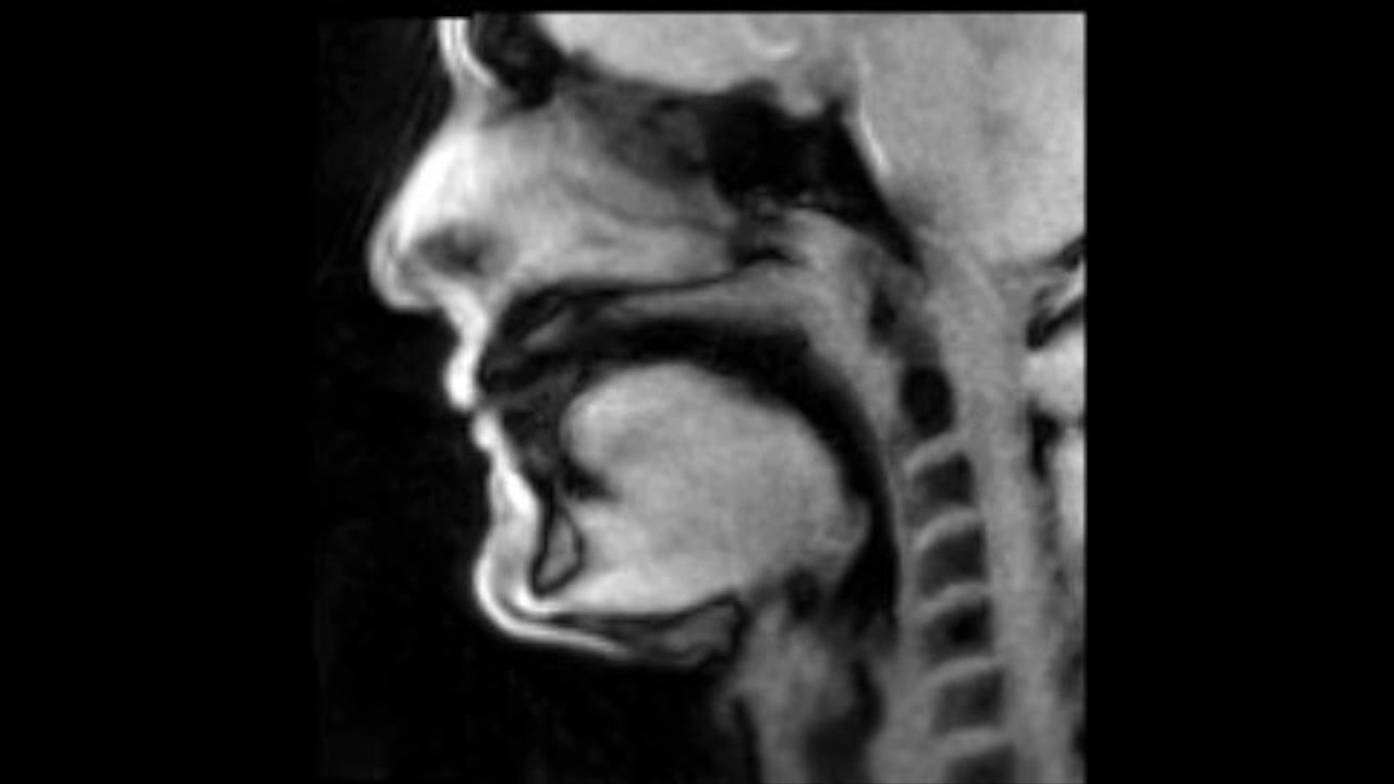 Douglas Yeo, trombone - MRI video 11 - bugle call 