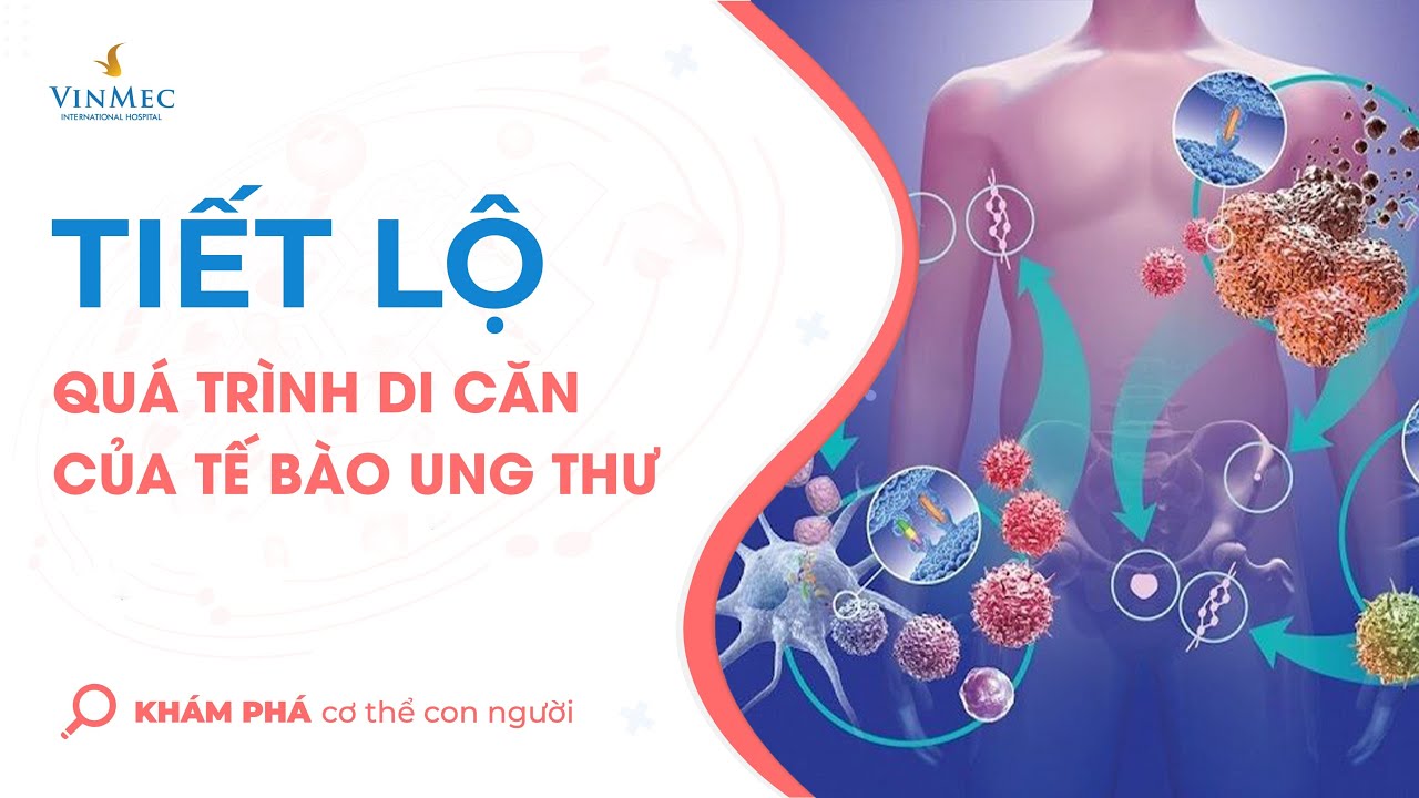 Tiết lộ qu&aacute; tr&igrave;nh di căn của tế b&agrave;o ung thư trong cơ thể con người