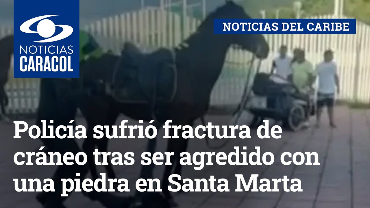 Policía sufrió fractura de cráneo tras ser agredido con una piedra en Santa Marta
