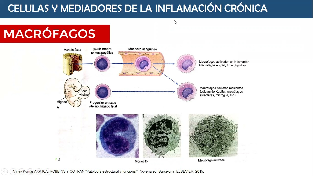 INFLAMACION CRONICA - SOCIEMAP