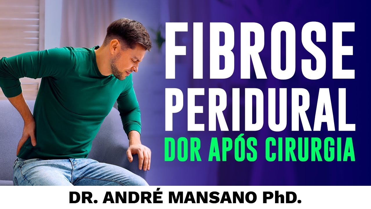Fibrose Peridural, Causa de Dor Após Cirurgia de Coluna – Dr. André Mansano Tratamento da Dor.