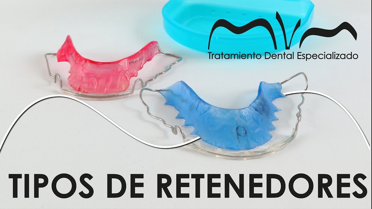 ¡RETENEDORES! |  ¿POR QUÉ LA ORTODONCIA CONTINÚA?