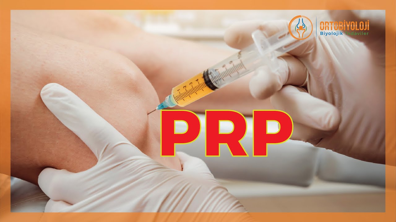 PRP - PLATELET RICH PLASMA