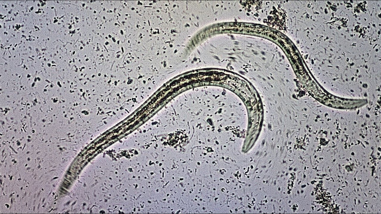 Strongyloidiasis — The deadly tropical disease you've probably never heard of.