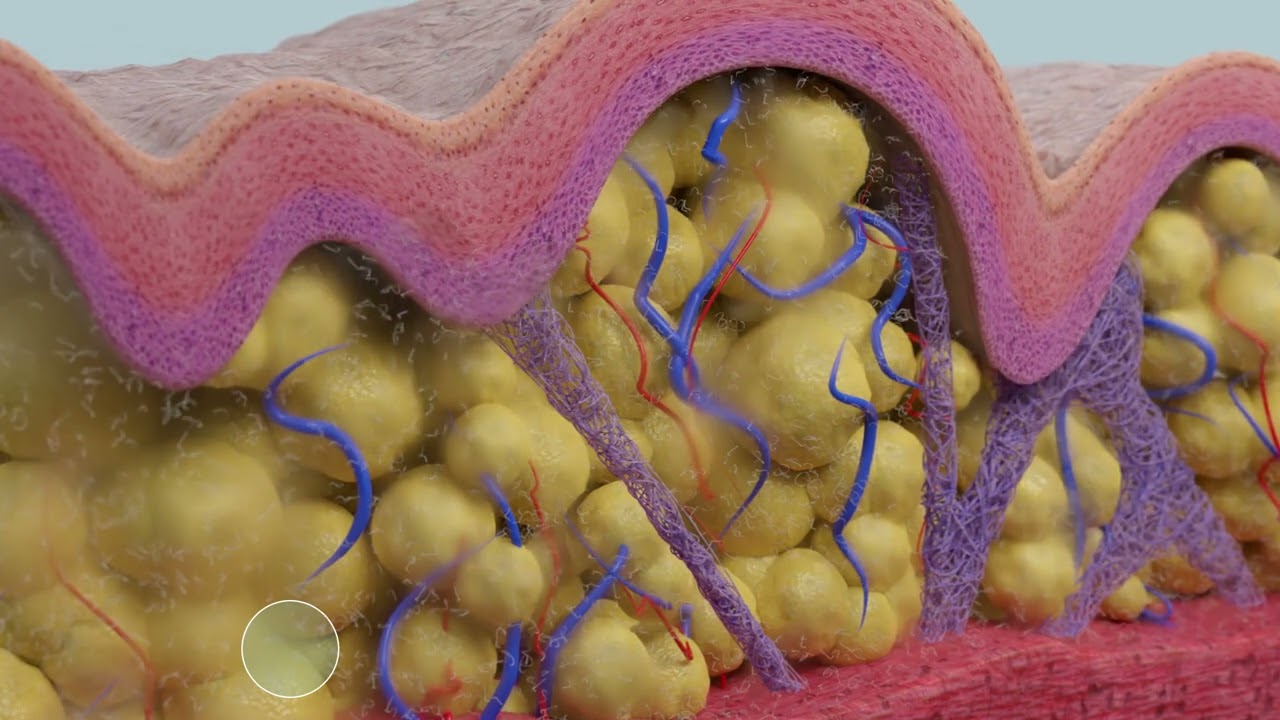 GoldIncision Como funciona