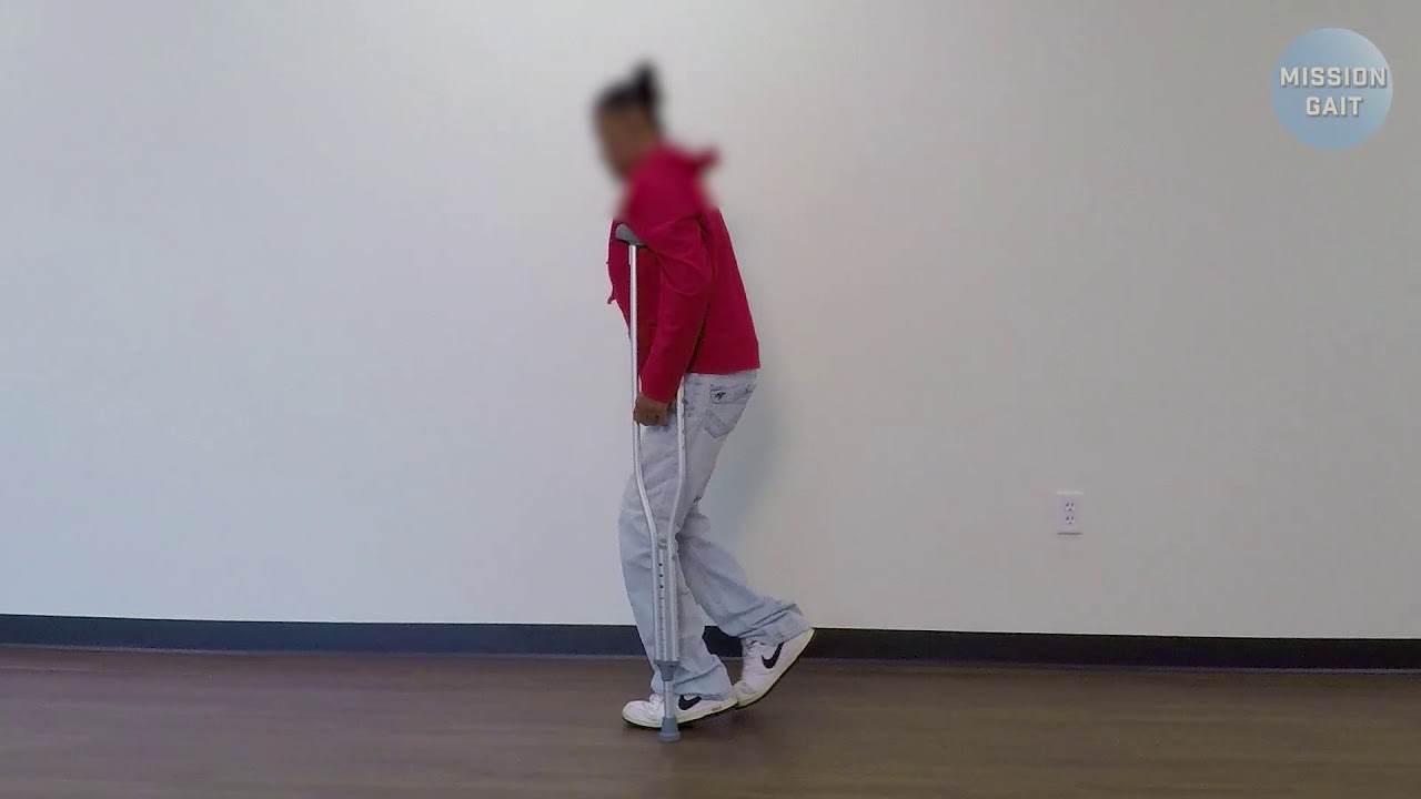 Conradi-Hünermann Gait - Case Study 16 (underarm crutches)