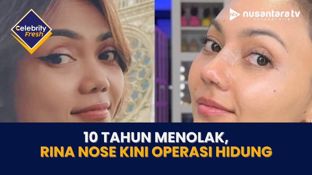 [LIVE] 10 Tahun Menolak, Rina Nose Kini Operasi Hidung | CELEBRITY FRESH