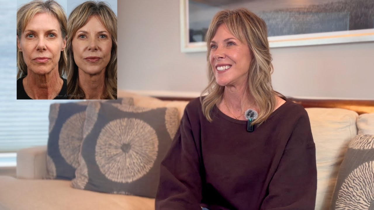 Deep Plane Facelift Journey in Her 50s | My Confidence is Boosted!
