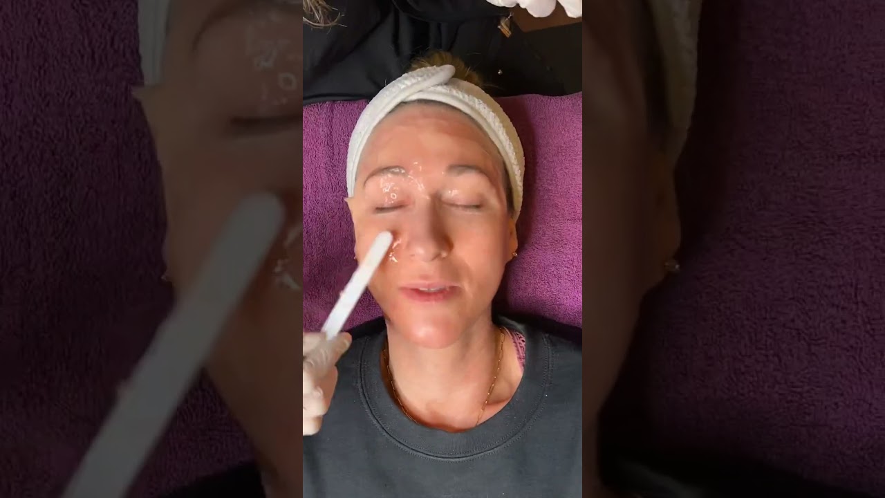 NEW! CO2 Lift Carboxy Gel Treatment