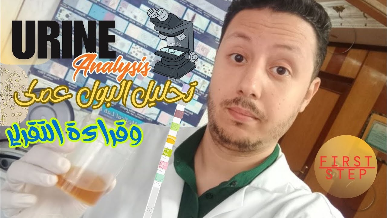 تحليل البول عملى - كل مراحل الفحص و قراءة التقرير #urine_analysis#البول #تحاليل_طبية #first_step