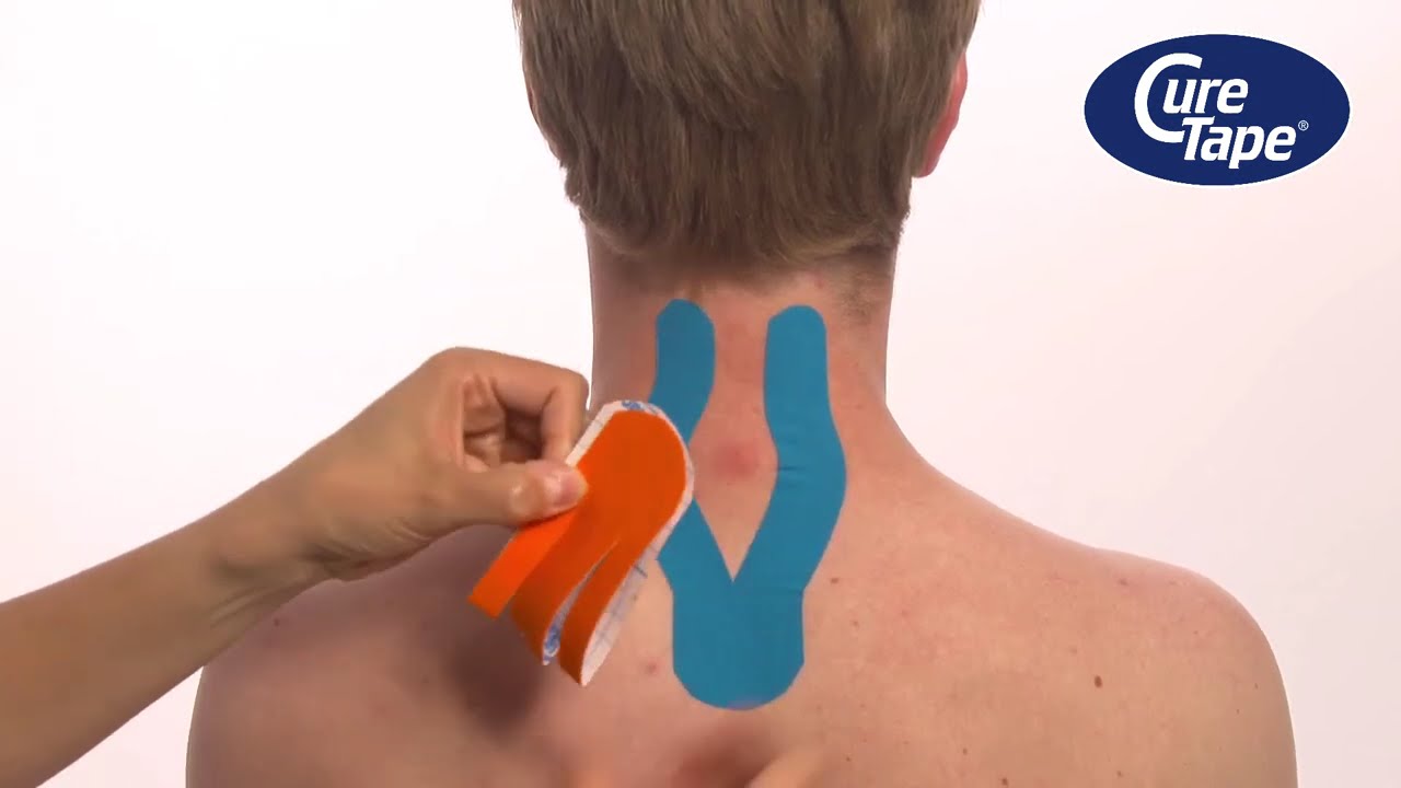 How to Tape Arthrosis or Cervical Spine Extension Problems Using CureTape Kinesiology Tape