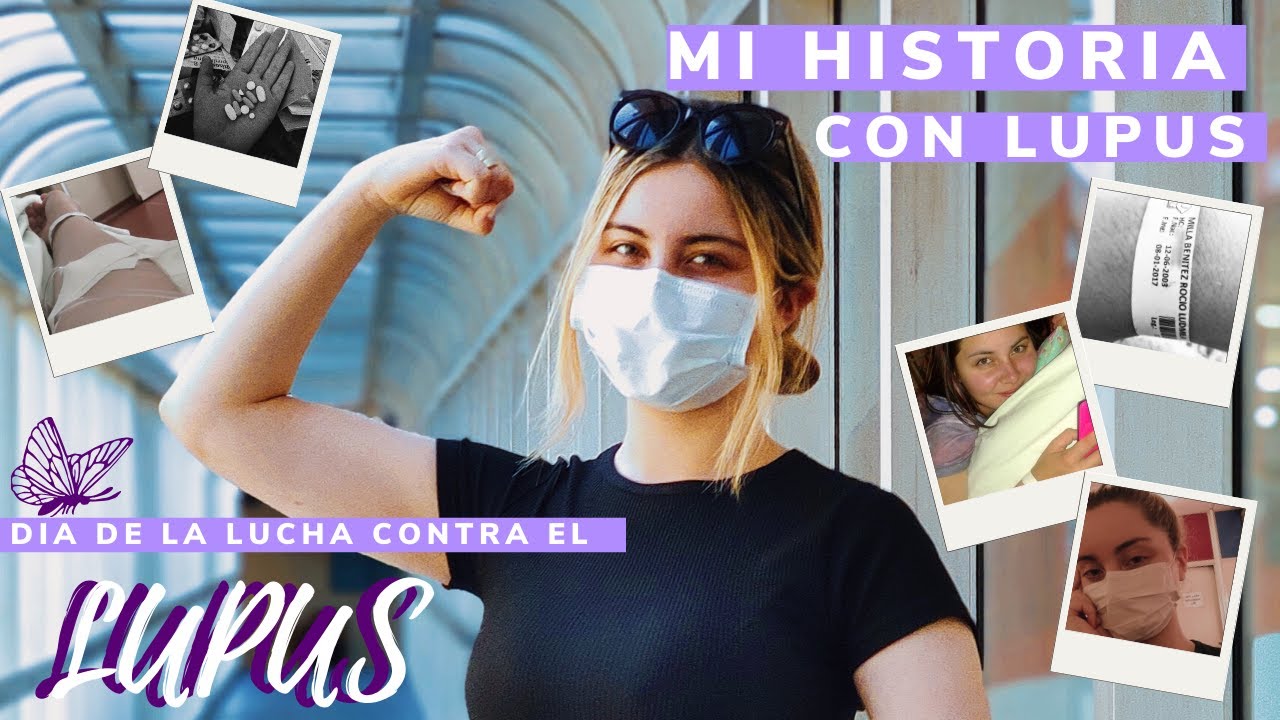 MI HISTORIA CON LUPUS (Info sobre lupus , mi experiencia , tratamiento, reflexion e internaciones)