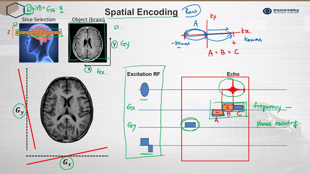 자기공명영상학 - Spatial Encoding