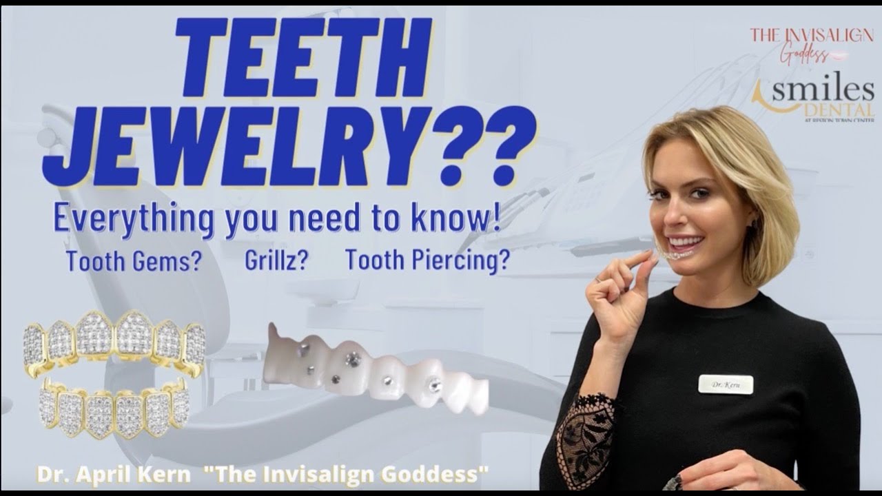 The Truth About Grillz | The Invisalign Goddess
