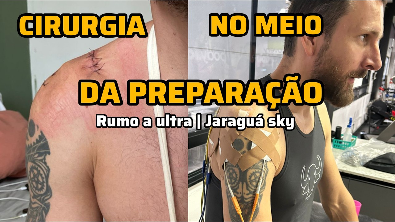 Operei o ombro durante a preparação para a ultra - Rumo a ultra | Jaraguá sky - EP. 2