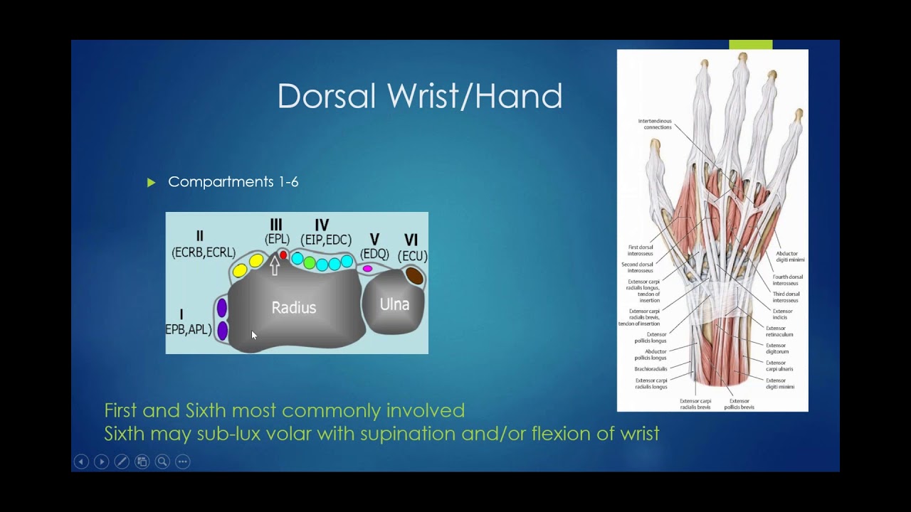 Diagnostic Ultrasound of the Wrist and Hand