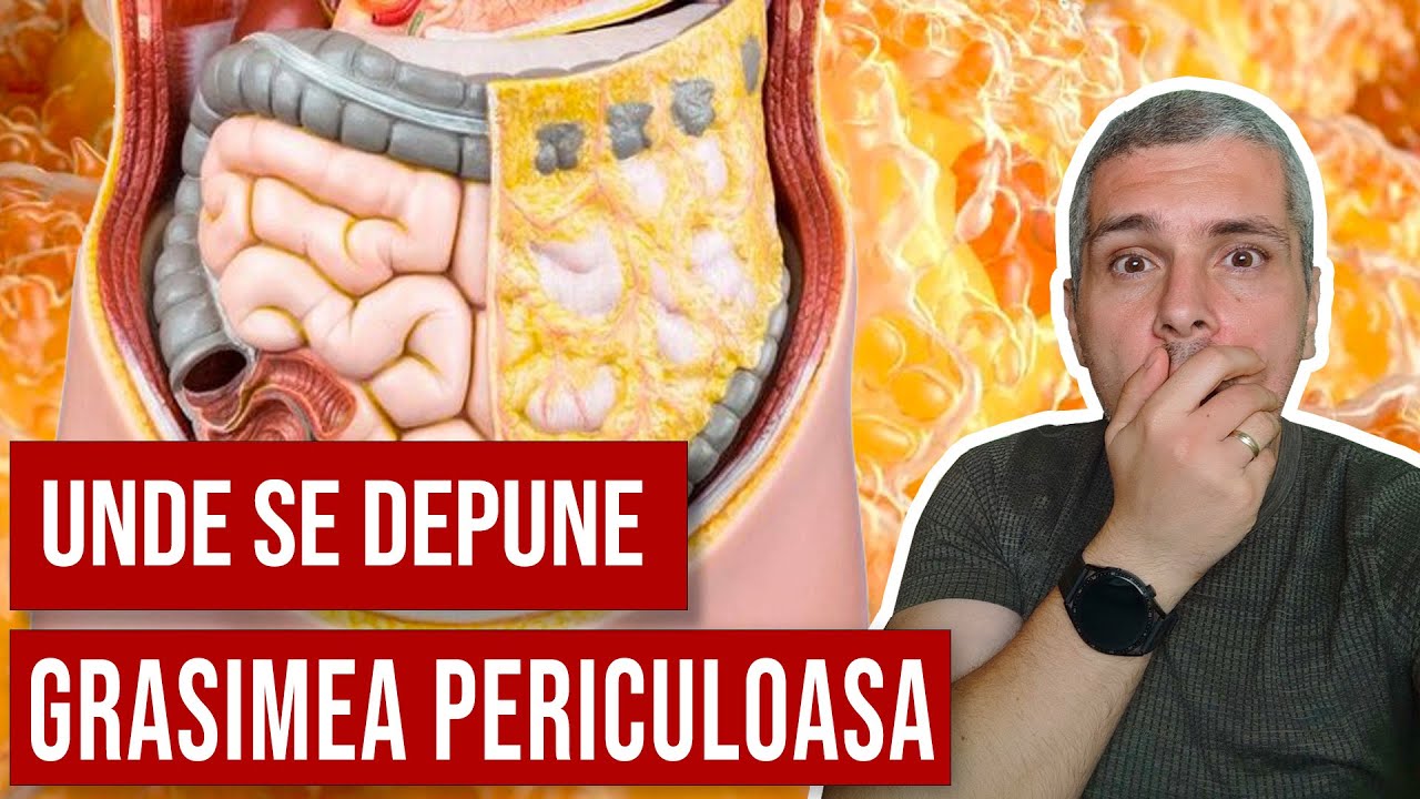Ce tipuri de depozite de grasime sunt cele mai periculoase