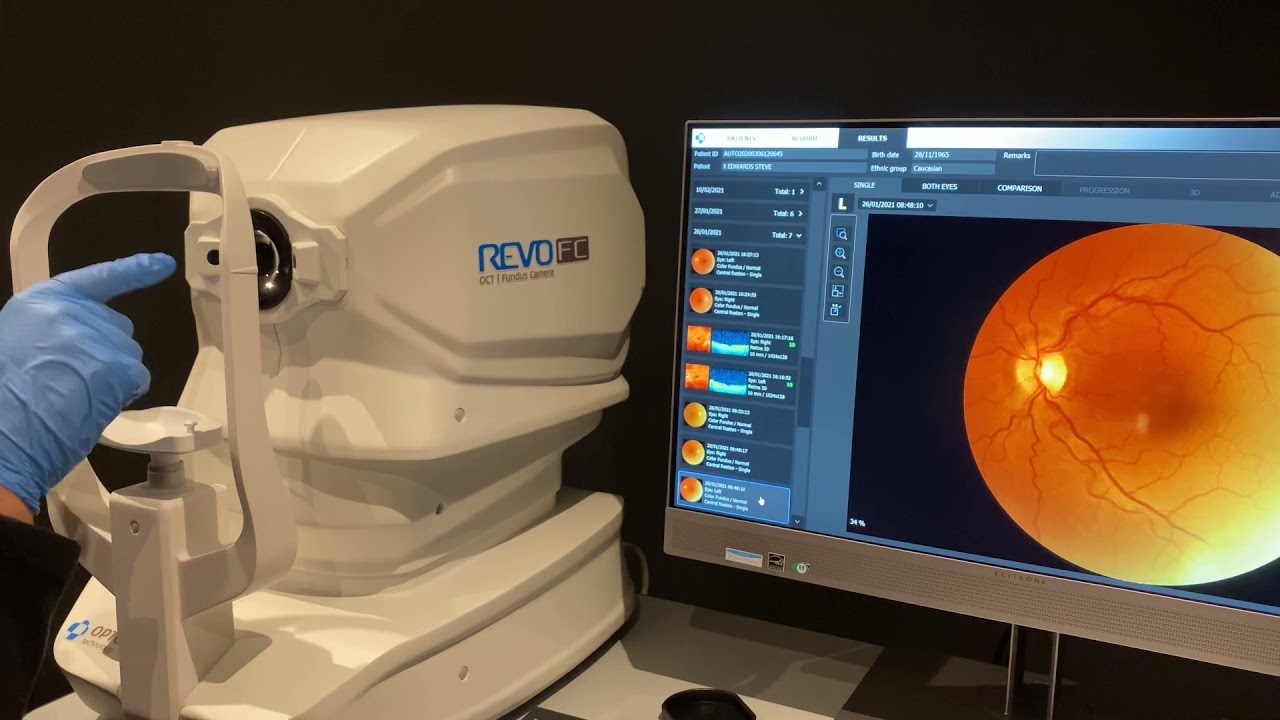 OCT Demo 3: fundus photography