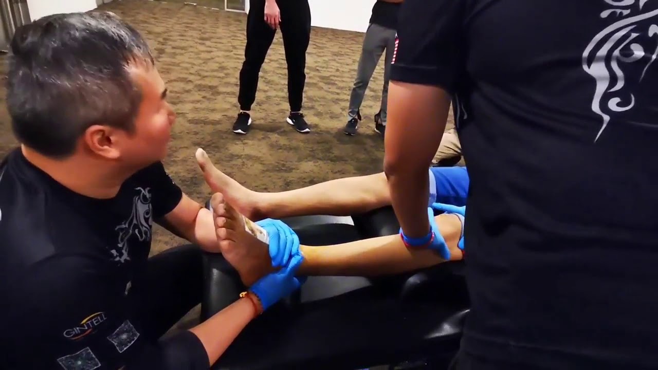 CLM Tit Tar Treatment For Patients Ankle Injury Due To Motorbike Accidents 🌍👍🏼💯💪🙏😘👌🏻❤🇲�