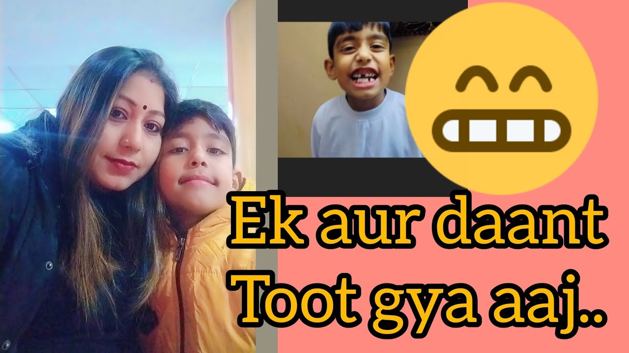 Ek aur daant toot gya😭#babytooth #viral #videoshort #explorepage #childhood 