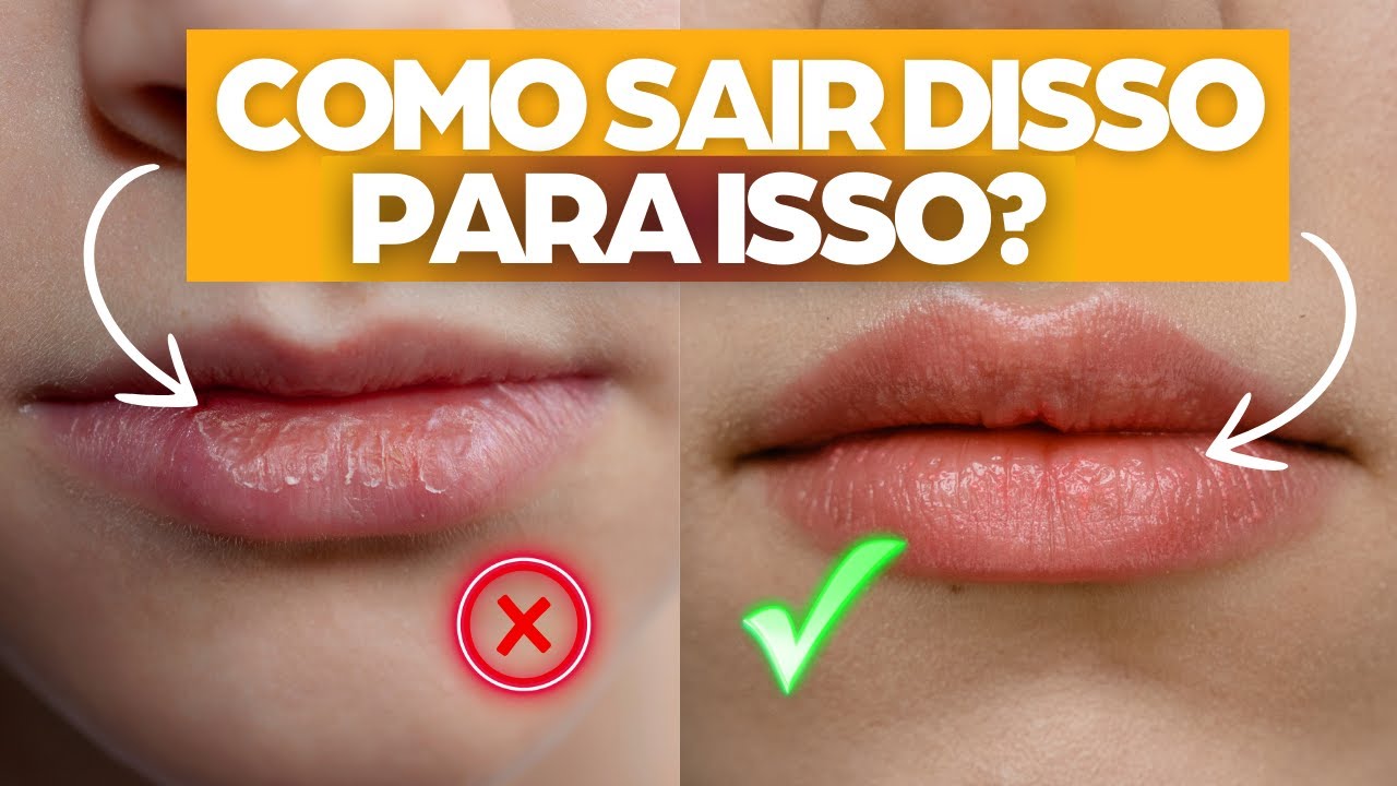 Como não ter mais lábios rachados com dicas da Esteticista | Hidratante labial