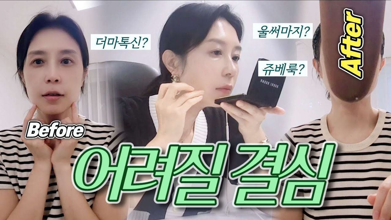 40대 피부과 시술 뭐해? 효과는? | 피부과 갔다가 쫓겨날 뻔 했어요