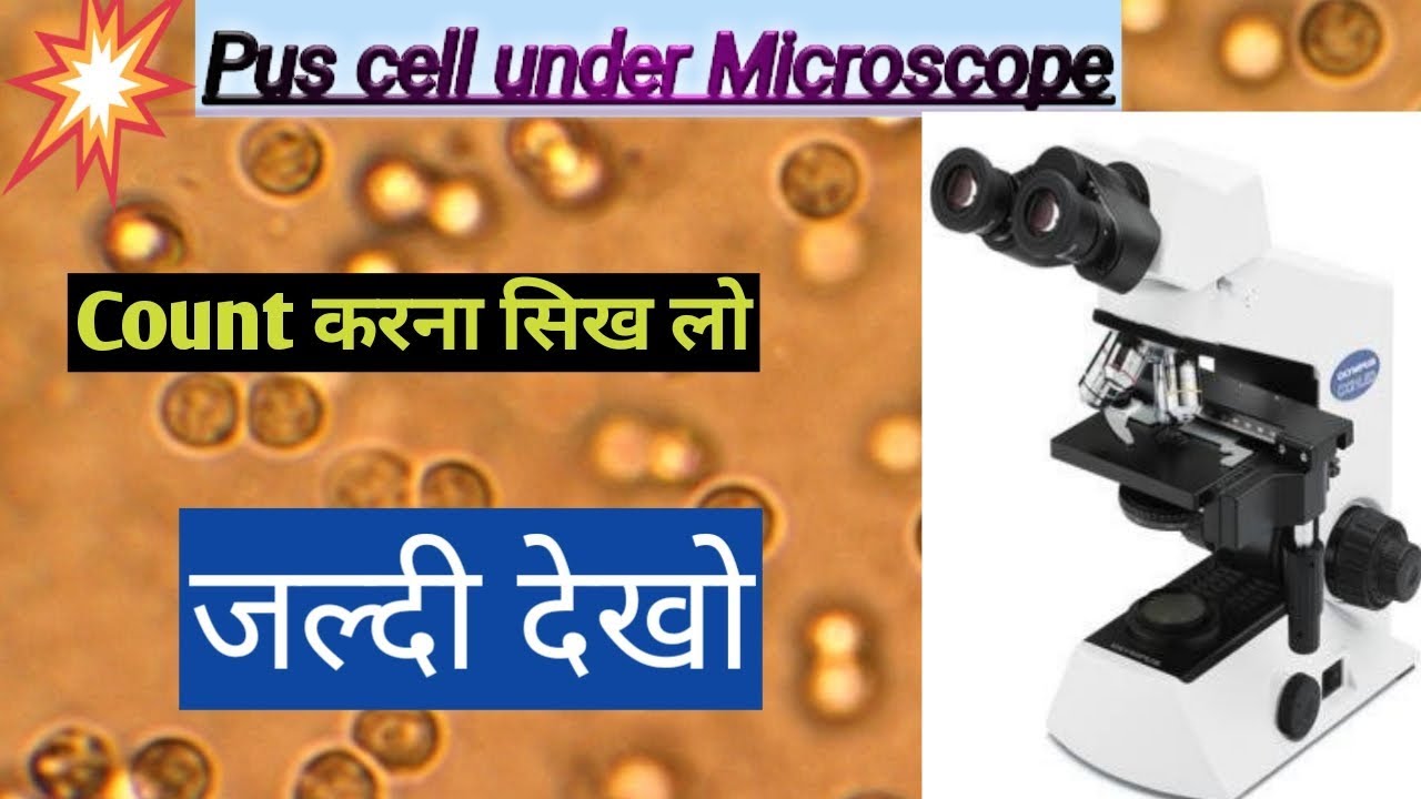 How to count Pus cell