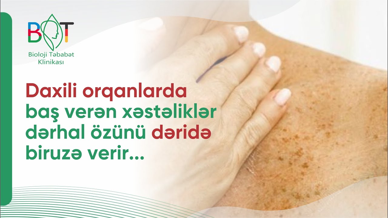 Dəridəki ləkələr hansı xəstəliyin xəbərçisidir? #dermatoloq