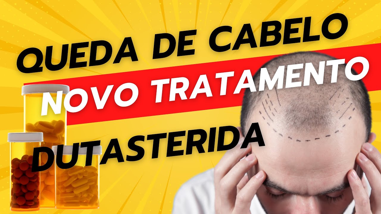 🚨 Dutasterida (Avodart): Meu novo passo no tratamento contra queda de cabelo!