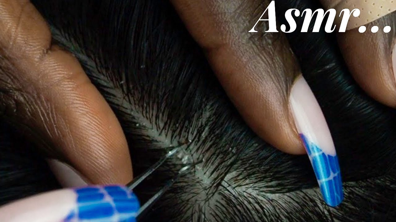 ASMR Super Attentive SCALP Nitpicking | blowing, tweezer, scratch sounds | whispered