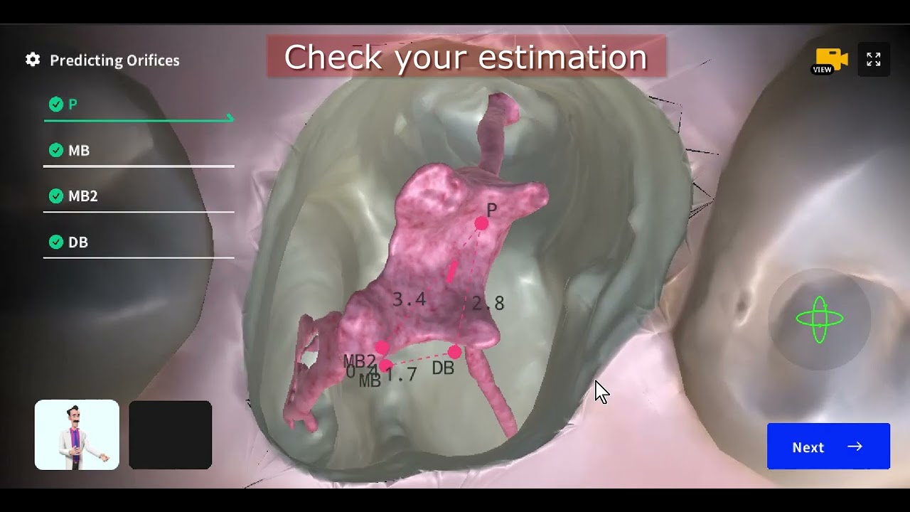 Dental EndoMaster Ver2 Preview