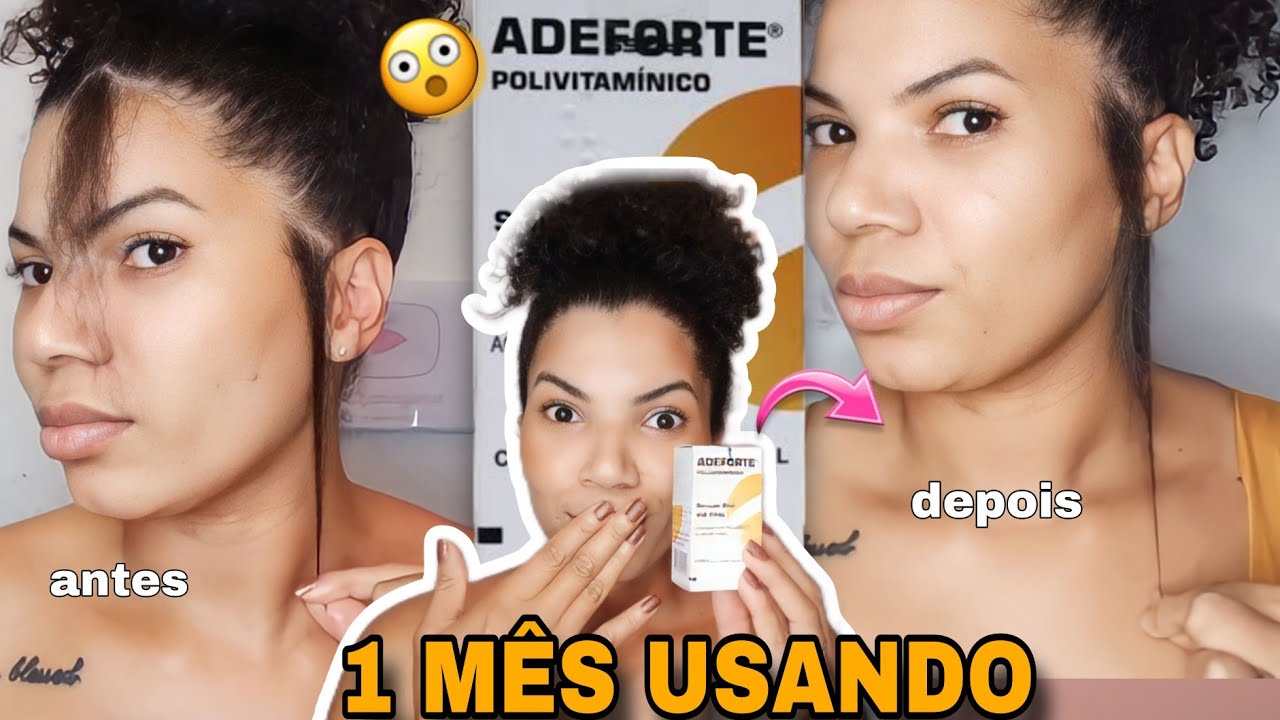 ADEFORTE a VITAMINA  que CRESCE CABELO/ ADEFORTE DEPOIS DE UM MÊS 😱